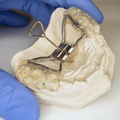 Palatal expansion: the benefits 3 Photo of a palatal expander, representing palatal expansion