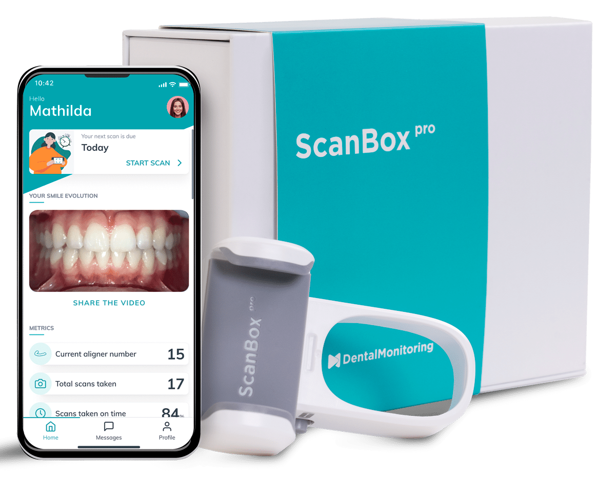 scan box for dental monitoring