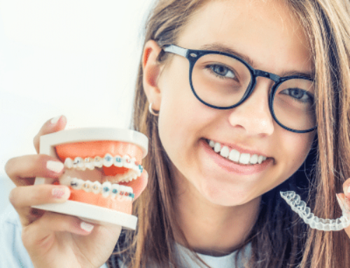 Navigating Foods with Braces or Aligners
