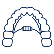 Rapid palate expander service grosso orthodontics